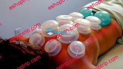 Cupping Massage Mastery